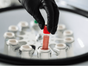 Calibrador Antiestreptolisina O (ASO/ASTO) Biosystems