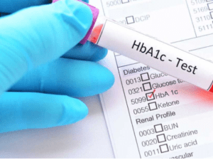 Control Elevado Hemoglobina Glicosilada Biosystems