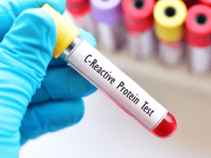 Proteina C Reactiva (PCR/CRP) Biosystems