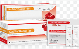 Hepatitis C Prueba en Casete - CTK BIOTECH